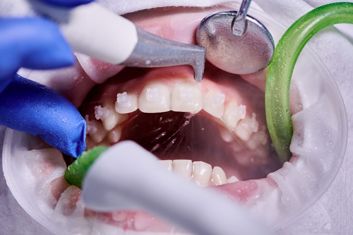 Periodontal disease near me